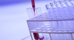 Infection à Chlamydia, vers un dépistage systématique Chlamydia IST infection sexuellement transmissible asymptomatique dépistage