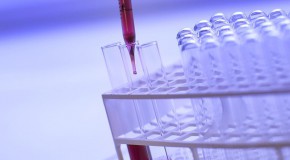 Cancer du col de l’utérus, lancement du dépistage généralisé cancer col utérus dépistage généralisation