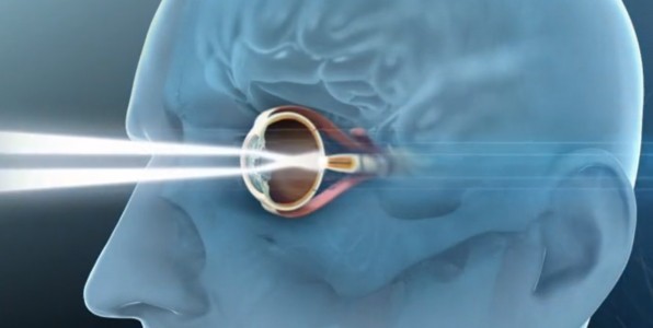 Le projet IRIS (Intelligent Retinal Implant Systems) a pour but de palier  la dficience rencontre au niveau des cellules de l'œil qui captent la lumire.