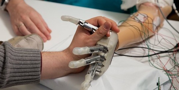 prothse bras amput test clinique bionique biomdical main nerfs sens toucher 