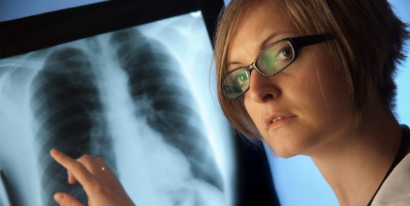 cancer du poumon haleine dpistage dtection COV composs organiques volatils