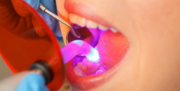 caries traitement dentaire cellules souches innovation dentaire laser