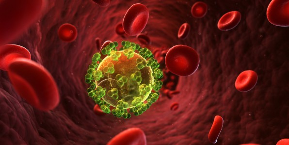 sida sclrose en plaques sropositifs vih facteur protecteur