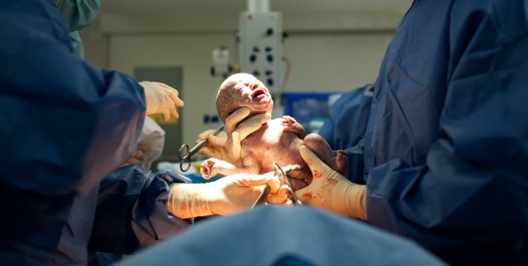 irlande du sud avortement IVG viol grossesse accouchement csarienne