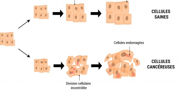 Dveloppement schmatique simple de cellules cancreuses