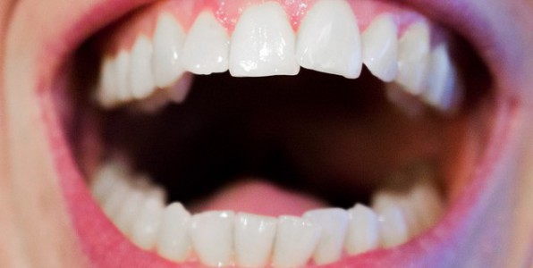 De belles dents sans passer chez le dentiste.