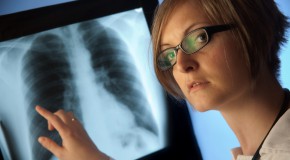 cancer du poumon haleine d�pistage d�tection COV compos�s organiques volatils