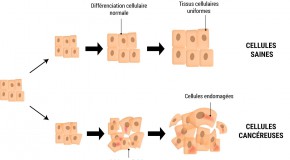cancer tumeur cellule canc�reuse canc�rig�ne diagnostic th�rapie recherche