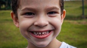 sport rentr�e scolaire activit� sportive orthodontie F�d�ration fran�aise d'orthodontie prot�ge-dents traumatisme