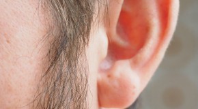 EarFold otoplastie implants oreilles dcolles