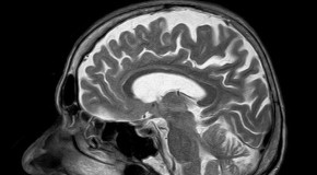 Iseult IRM recherche cerveau humain cartographie imagerie