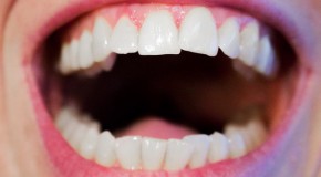 dent dentiste probl�me dentaire hygi�ne soucis
