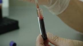 d�tection d�pistage cancer prise de sang test sanguin
