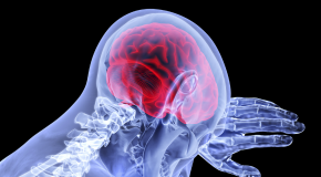 AVC accident vasculaire c�r�bral c�r�braux causes s�quelles