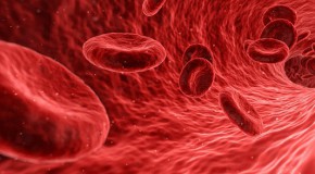 cancer sang leuc�mie CAR-T th�rapie g�nique traitement r�mission