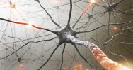 sclrose en plaque statines cholestrol nvrite optique neurologie auto-immune placbo simvastatine myline atrophie crbrale IRM