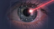 tatouage chirurgien oculaire œil yeux laser femtoseconde glaucome cataracte myopie presbytie