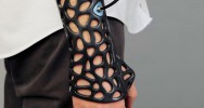 Cortex jack evill osteoid Deniz karahasin lectrodes pltre bras ar ultrason radiographie prix A'Design