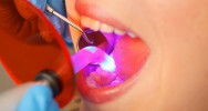 caries traitement dentaire cellules souches innovation dentaire laser