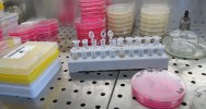 antibiorsistance bactrie antibiorsistante OMS sant mondialeantibiotique rsistant recherche