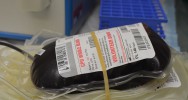 transfusion don sang gestion sant publique